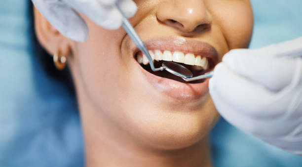 Best Emergency Root Canal Therapy in Evendale, OH