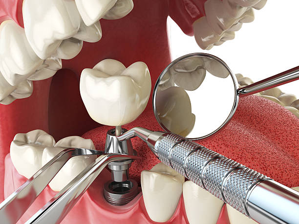 Best Emergency Cosmetic Dentistry (e.g., broken veneers) in Evendale, OH